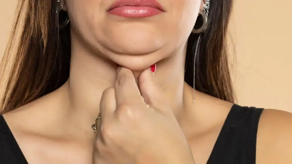 An image of a woman with double chin, sad, worried : Non Surgical Double Chin Removal Treatment in Merthyr Tydfil, UK