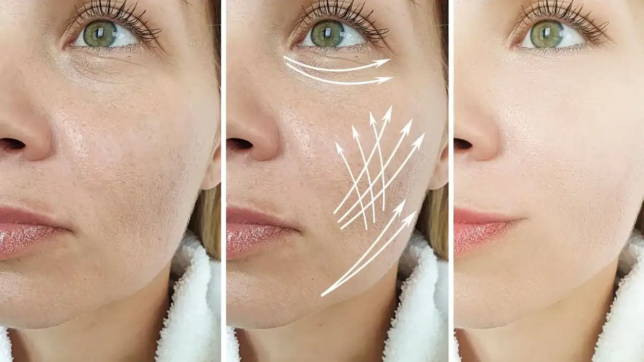 Can One Treatment Really Tackle More Than One Skin Concern Merthyr Tydfil?