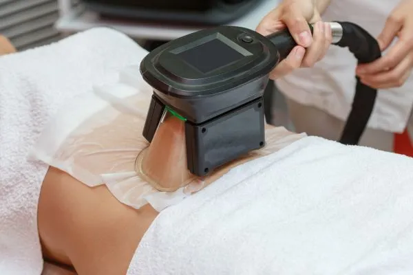 Image of person having fat freezing treatment to help weight gain Merthyr Tydfil