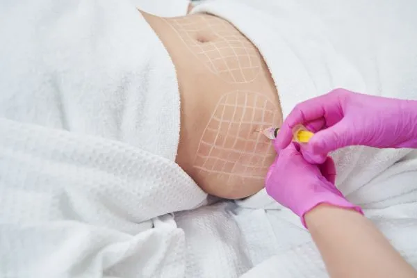 image of fat dissolving injections on love handles to help combat weight gain Merthyr Tydfil