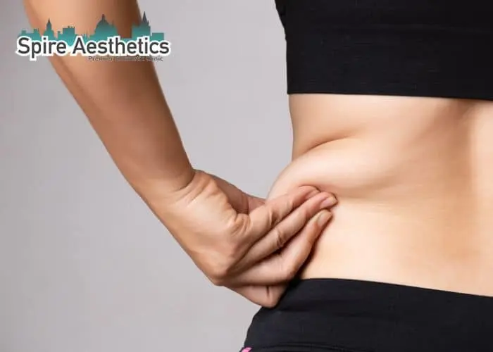 Image of woman pinching fat on their hips Merthyr Tydfil. Fat Freezing treatment