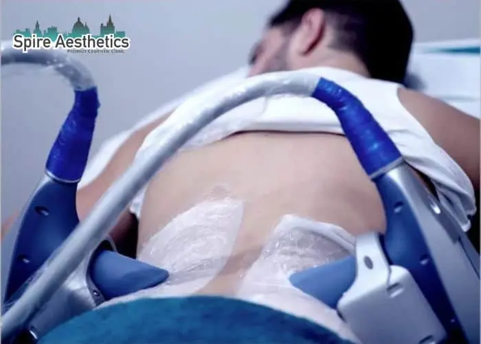 Man having fat freezing treatment done on love handles before a competitions Merthyr Tydfil to create a sculpted look.