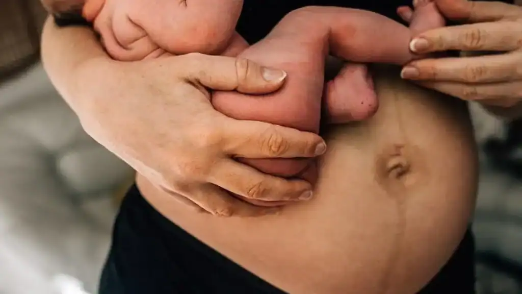 Why Is My Stomach Still Big After Pregnancy Merthyr Tydfil?